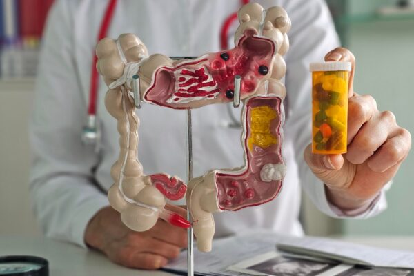 Mucus în scaun: când poate fi util un consult gastroenterologic